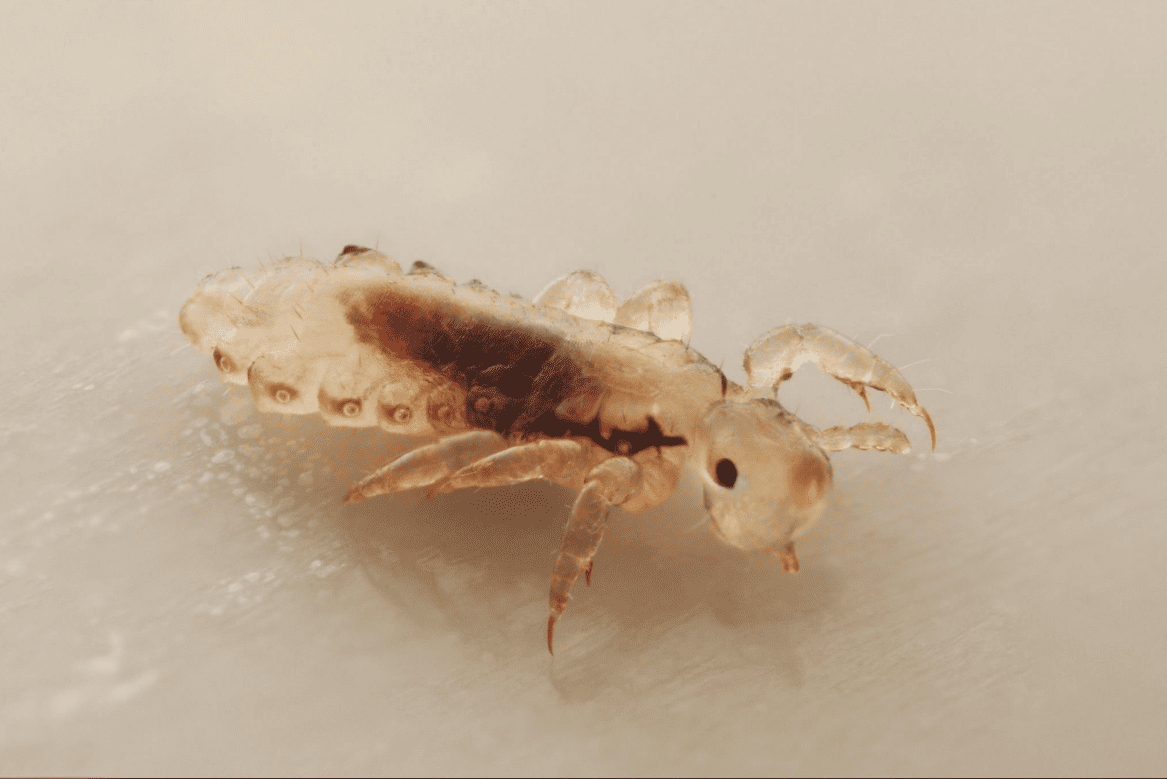 Causes of Head Lice
