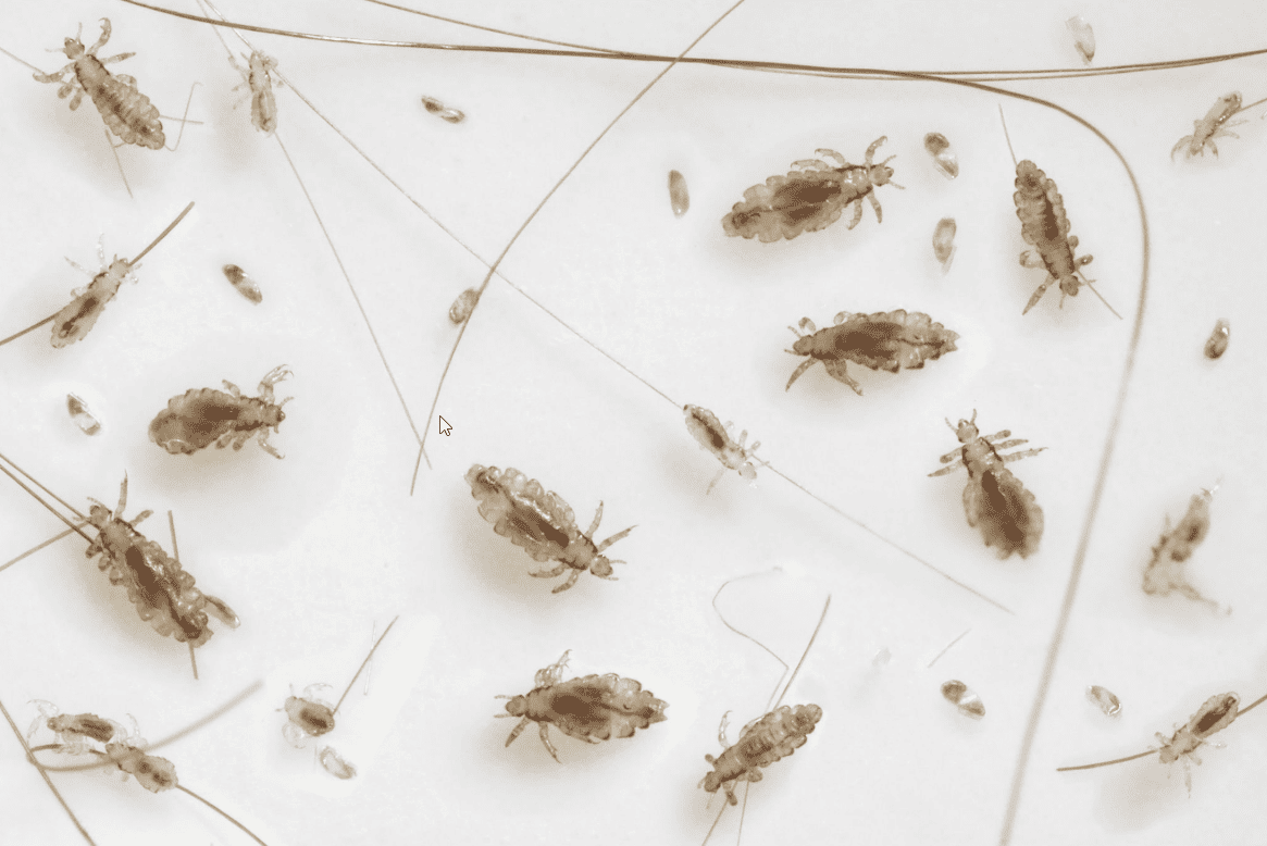Head Lice Facts