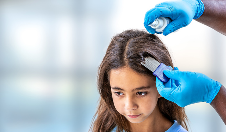 Head Lice Treatment